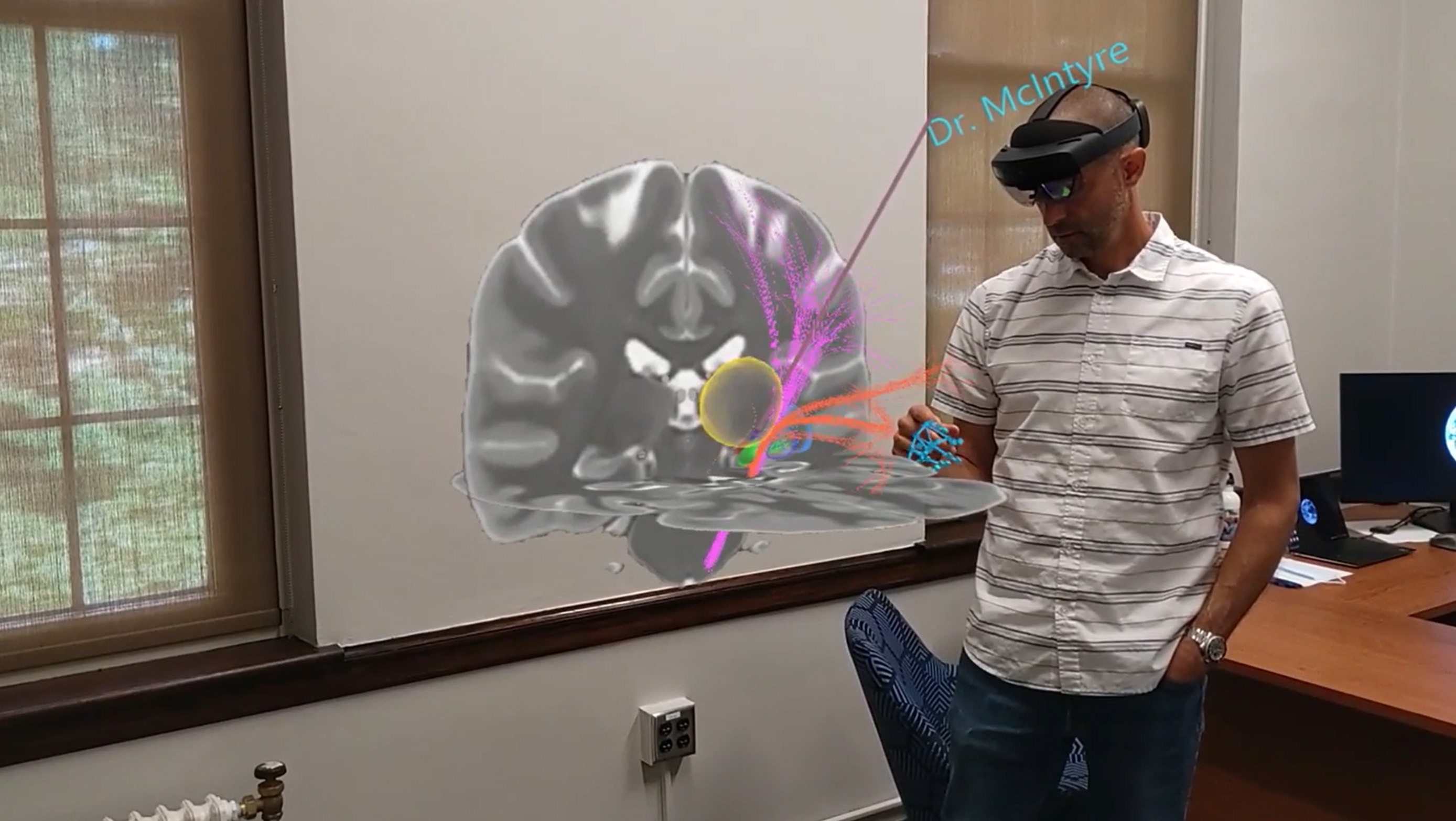 Traditional 2D brain scan slices on a medical monitor, showing the limitations of flat imaging for 3D surgical planning.