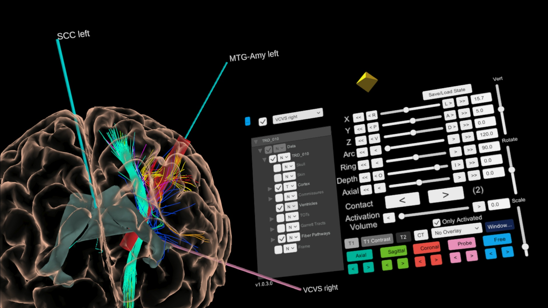 The holographic brain map showing precise electrode placement coordinates, with $2.3M NIH grant and Neuron publication badges overlaid.